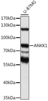 Western Blot: ANKK1 Antibody [NBP2-92306] - Analysis of extracts of U-87MG cells, using ANKK1 at 1:1000 dilution.Secondary antibody: HRP Goat Anti-Rabbit IgG (H+L) at 1:10000 dilution.Lysates/proteins: 25ug per lane.Blocking buffer: 3% nonfat dry milk in TBST.Detection: ECL Basic Kit .Exposure time: 30s.