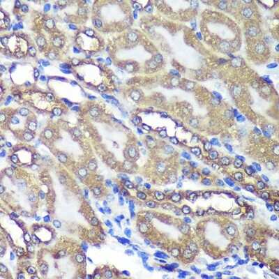 Immunohistochemistry-Paraffin ANKLE2 Antibody - Azide and BSA Free