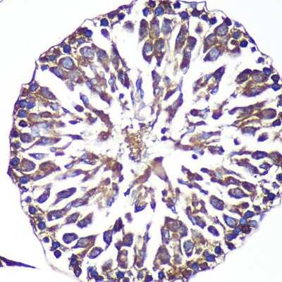 Immunohistochemistry-Paraffin ANKLE2 Antibody - Azide and BSA Free