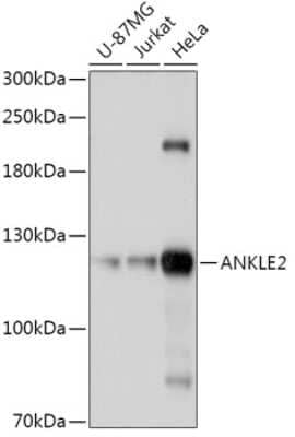 Western Blot ANKLE2 Antibody - Azide and BSA Free