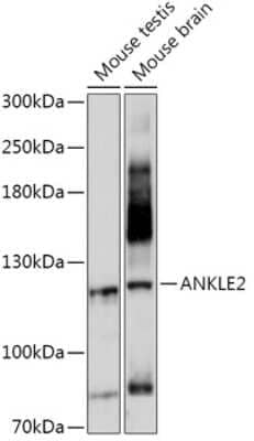 Western Blot: ANKLE2 Antibody [NBP2-92368] - Analysis of extracts of various cell lines, using ANKLE2 at 1:1000 dilution.Secondary antibody: HRP Goat Anti-Rabbit IgG (H+L) at 1:10000 dilution.Lysates/proteins: 25ug per lane.Blocking buffer: 3% nonfat dry milk in TBST.Detection: ECL Basic Kit .Exposure time: 10s.
