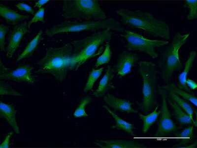Immunocytochemistry/Immunofluorescence: ANKMY1 Antibody [H00051281-B01P] - Analysis of purified antibody to ANKMY1 on HeLa cell. (antibody concentration 10 ug/ml)