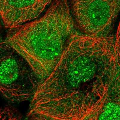 Immunocytochemistry/Immunofluorescence: ANKMY1 Antibody [NBP1-82179] - Staining of human cell line A-431 shows localization to nucleus, nuclear bodies & cytosol.