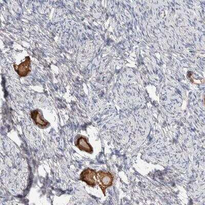 Immunohistochemistry-Paraffin: ANKMY1 Antibody [NBP1-82179] - Staining of human ovary shows strong cytoplasmic positivity in follicle cells.