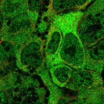 Immunocytochemistry/Immunofluorescence: ANKMY2 Antibody [NBP2-57818] - Staining of human cell line CACO-2 shows localization to nucleoplasm & cytosol.