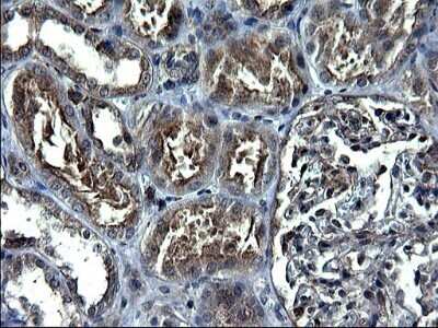 Immunohistochemistry: ANKMY2 Antibody (OTI1F11) - Azide and BSA Free [NBP2-72073] - Analysis of Human Kidney tissue. (Heat-induced epitope retrieval by 1 mM EDTA in 10mM Tris, pH8.5, 120C for 3min)