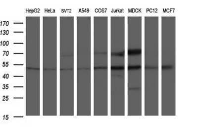 Western Blot: ANKMY2 Antibody (OTI1F11) - Azide and BSA Free [NBP2-72073] - Analysis of extracts (35ug) from 9 different cell lines by using ANKMY2 monoclonal antibody (HepG2: human; HeLa: human; SVT2: mouse; A549: human; COS7: monkey; Jurkat: human; MDCK: canine; PC12: rat; MCF7: human).