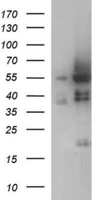 Western Blot: ANKMY2 Antibody (OTI1F11) - Azide and BSA Free [NBP2-72073] - Analysis of HEK293T cells were transfected with the pCMV6-ENTRY control (Left lane) or pCMV6-ENTRY ANKMY2 .