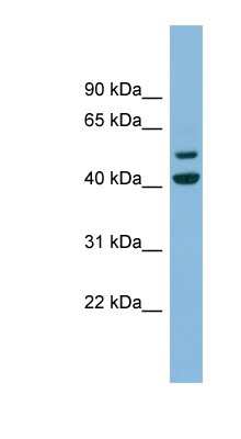 Western Blot: ANKMY2 Antibody [NBP1-55412] - Human Muscle lysate, concentration 0.2-1 ug/ml.