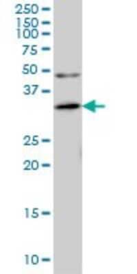 Western Blot: ANKRA2 Antibody (1D11) [H00057763-M01] - ANKRA2 monoclonal antibody (M01), clone 1D11 Analysis of ANKRA2 expression in IMR-32.