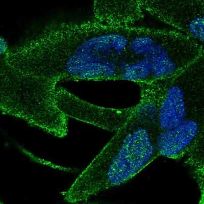 Immunocytochemistry/Immunofluorescence: ANKRA2 Antibody [NBP2-57230] - Staining of human cell line RH-30 shows localization to nucleoplasm & plasma membrane.