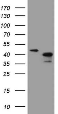 Western Blot: ANKRA2 Antibody (OTI8A9) - Azide and BSA Free [NBP2-72105] - Analysis of HEK293T cells were transfected with the pCMV6-ENTRY control (Left lane) or pCMV6-ENTRY ANKRA2.