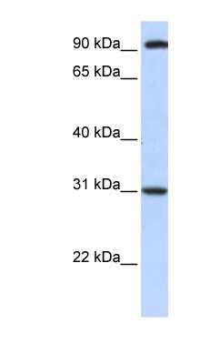 Western Blot: ANKRA2 Antibody [NBP1-79395] - Titration: 0.2-1 ug/ml, Positive Control: Hela cell lysate.