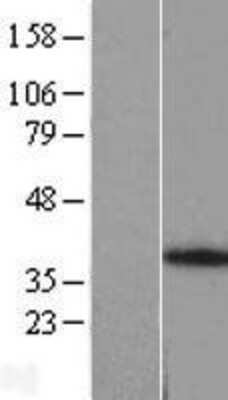 Western Blot: ANKRA2 Overexpression Lysate (Adult Normal) [NBL1-07532] Left-Empty vector transfected control cell lysate (HEK293 cell lysate); Right -Over-expression Lysate for ANKRA2.