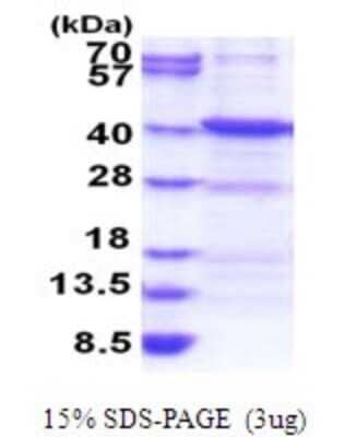 SDS-Page: ANKRA2 Recombinant Protein [NBP2-51799] - 15% SDS Page (3 ug)