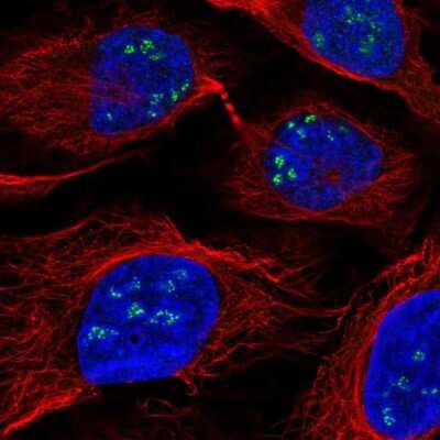 Immunocytochemistry/Immunofluorescence: ANKRD1 Antibody [NBP2-14292] - Staining of human cell line U-2 OS shows localization to nucleoli fibrillar center. Antibody staining is shown in green.
