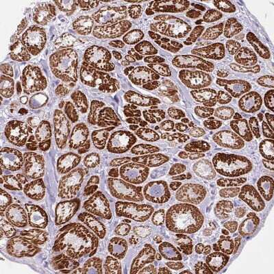 Immunohistochemistry-Paraffin: ANKRD1 Antibody [NBP2-14292] - Staining of human heart shows moderate cytoplasmic positivity in cardiomyocytes.