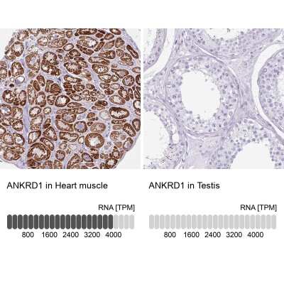 Immunohistochemistry-Paraffin: ANKRD1 Antibody [NBP2-14292] - Staining in human heart muscle and testis tissues . Corresponding ANKRD1 RNA-seq data are presented for the same tissues.