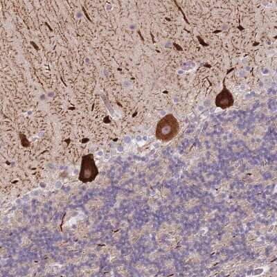 Immunohistochemistry: ANKRD10 Antibody [NBP2-37890] - Staining of human cerebellum shows strong cytoplasmic positivity in Purkinje cells.