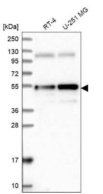 Western Blot: ANKRD10 Antibody [NBP2-37891] - Analysis in human cell line RT-4 and human cell line U-251 MG.