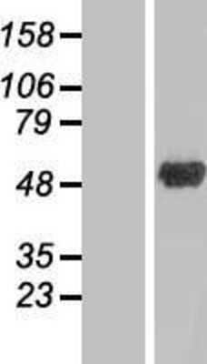 Western Blot: ANKRD10 Overexpression Lysate (Adult Normal) [NBP2-06954] Left-Empty vector transfected control cell lysate (HEK293 cell lysate); Right -Over-expression Lysate for ANKRD10.