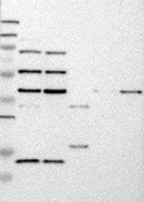Western Blot: ANKRD11 Antibody [27880002] - Samples:  Lane 1, Marker [kDa]: 250, 130, 95, 72, 55, 36, 28, 17, 11  Lane 2, RT-4  Lane 3, U-251MG sp  Lane 4, Human Plasma  Lane 5, Liver  Lane 6, Tonsil,  Target weight [kDa]:  298, 72, 49, 40, 13 (splice variants)  Validation score:  2   Validation description:  Supportive - Band of predicted size in kDa (+/-20%) with additional bands present.