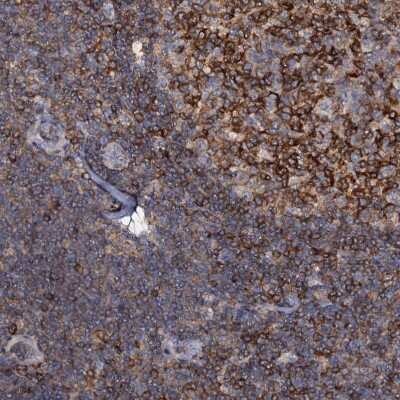 Immunohistochemistry-Paraffin ANKRD13A Antibody - BSA Free