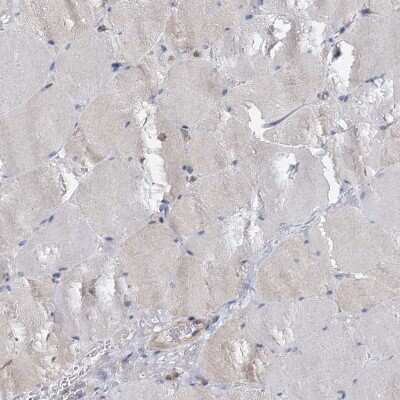 Immunohistochemistry-Paraffin ANKRD13A Antibody - BSA Free