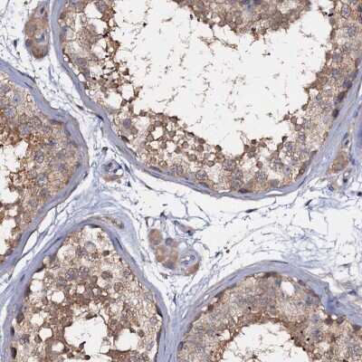 Immunohistochemistry-Paraffin ANKRD13A Antibody - BSA Free