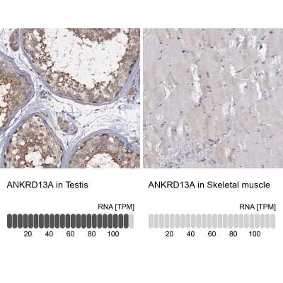 Immunohistochemistry-Paraffin ANKRD13A Antibody - BSA Free