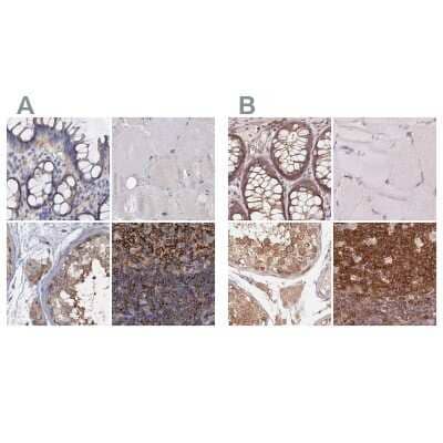Immunohistochemistry-Paraffin ANKRD13A Antibody - BSA Free