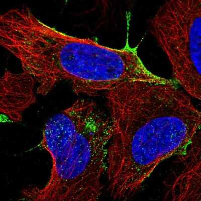 Immunocytochemistry/Immunofluorescence: ANKRD13B Antibody [NBP2-49404] - Immunofluorescent staining of human cell line U-2 OS shows localization to vesicles.