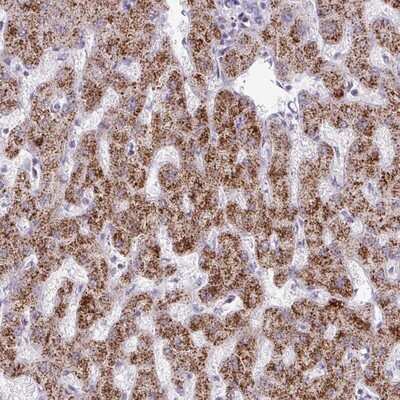 Immunohistochemistry-Paraffin: ANKRD13B Antibody [NBP2-14293] - Staining of human liver shows strong cytoplasmic positivity in hepatocytes.