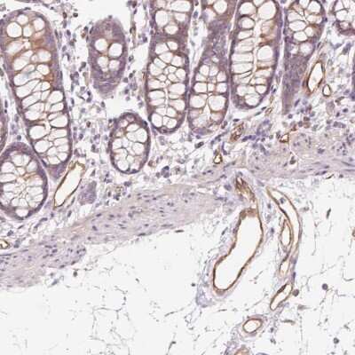 Immunohistochemistry-Paraffin: ANKRD13B Antibody [NBP2-49404] - Staining of human colon shows moderate cytoplasmic positivity in glandular cells along with distinct positivity in endothelial cells.