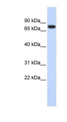 Western Blot: ANKRD13B Antibody [NBP1-91433] - Human Heart lysate, concentration 0.2-1 ug/ml.