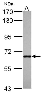 Western Blot: ANKRD13B Antibody [NBP2-15398] - Sample (30 ug of whole cell lysate) A: A431 7. 5% SDS PAGE; antibody diluted at 1:1000.