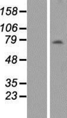 Western Blot ANKRD13B Overexpression Lysate