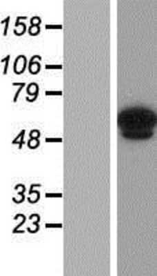 Western Blot: ANKRD13C Overexpression Lysate (Adult Normal) [NBP2-06177] Left-Empty vector transfected control cell lysate (HEK293 cell lysate); Right -Over-expression Lysate for ANKRD13C.