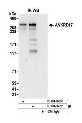 <b>Independent Antibodies Validation. </b>Immunoprecipitation: ANKRD17 Antibody [NB100-86995] - Detection of human ANKRD17 by western blot of immunoprecipitates. Samples: Whole cell lysate (1.0 mg per IP reaction; 20% of IP loaded) from HeLa cells prepared using NETN lysis buffer. Antibodies: Affinity purified rabbit anti-ANKRD17 antibody NB100-86995 used for IP at 3 ug per reaction. ANKRD17 was also immunoprecipitated by rabbit anti-ANKRD17 antibody NB100-86996. For blotting immunoprecipitated ANKRD17, NB100-86995 was used at 0.4 ug/ml. Detection: Chemiluminescence with an exposure time of 30 seconds.