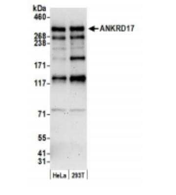 Western Blot: ANKRD17 Antibody [NB100-86995] - Whole cell lysate (15 ug) from HeLa and 293T cells prepared using NETN lysis buffer. Antibody: Affinity purified rabbit anti-ANKRD17 antibody used for WB at 0.1 ug/ml. Detection: Chemiluminescence with an exposure time of 3 minutes.