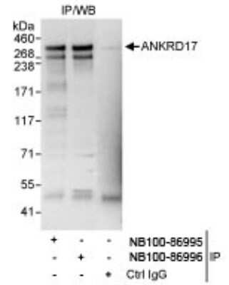 <b>Independent Antibodies Validation. </b>Immunoprecipitation: ANKRD17 Antibody [NB100-86996] - Whole cell lysate (1 mg for IP, 20% of IP loaded) from HeLa cells.  NB100-86996 used for IP at 3 mcg/mg lysate. ANKRD17 was also immunoprecipitated by rabbit anti-ANKRD17 antibody NB100-86995, which recognizes an upstream epitope.