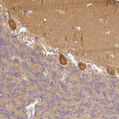 Immunohistochemistry: ANKRD18A Antibody [NBP2-48843] - Staining of human cerebellum shows strong cytoplasmic positivity in Purkinje cells.