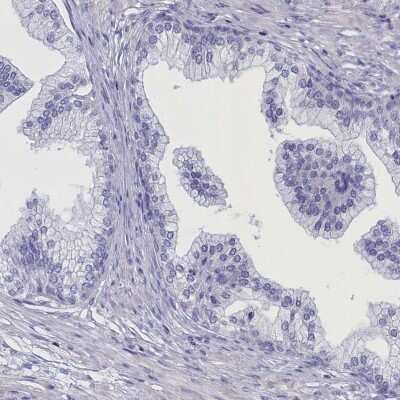 Immunohistochemistry-Paraffin ANKRD2 Antibody - BSA Free