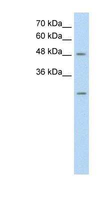 Western Blot: ANKRD2 Antibody [NBP1-56443] - HepG2 cell lysate, concentration 0.2-1 ug/ml.