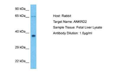 Western Blot: ANKRD2 Antibody [NBP2-87001] - Host: Rabbit. Target Name: ANKRD2. Sample Type: Fetal Liver lysates. Antibody Dilution: 1.0ug/ml