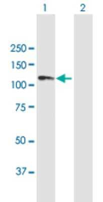 Western Blot: ANKRD20A1 Antibody [H00084210-B02P] - Analysis of ANKRD20A1 expression in transfected 293T cell line by ANKRD20A1 polyclonal antibody.  Lane 1: ANKRD20A1 transfected lysate(91.35 KDa). Lane 2: Non-transfected lysate.