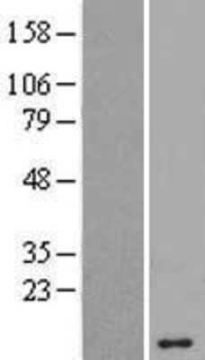 Western Blot ANKRD20A5 Overexpression Lysate