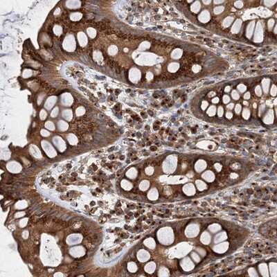 Immunohistochemistry-Paraffin ANKRD26 Antibody - BSA Free