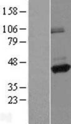 Western Blot: ANKRD26P1 Overexpression Lysate (Adult Normal) [NBL1-10768] Left-Empty vector transfected control cell lysate (HEK293 cell lysate); Right -Over-expression Lysate for ANKRD26P1.