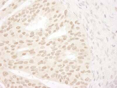 Immunohistochemistry ANKRD28 Antibody